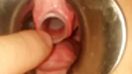 Mignon et corné étud ...